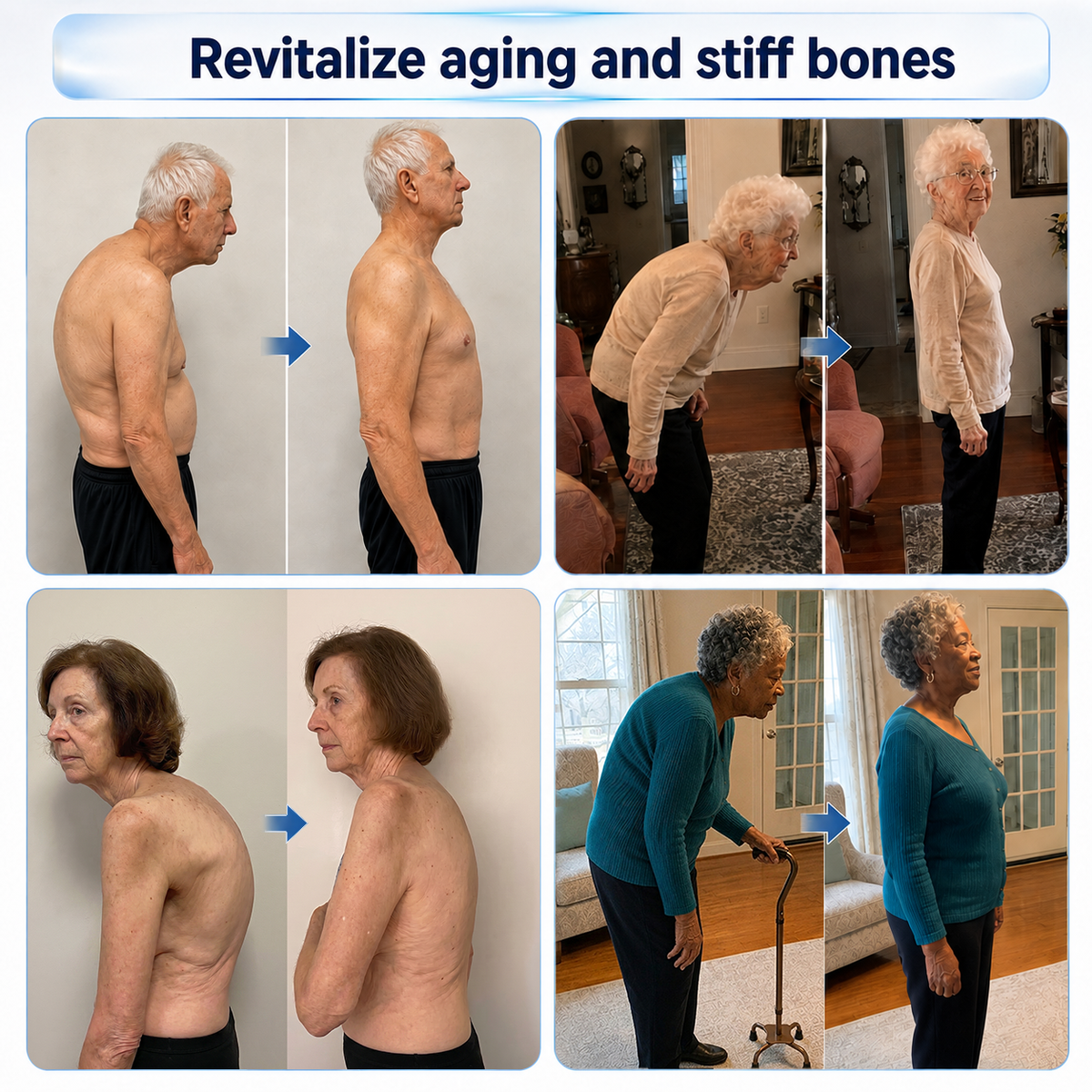 TERVENCE® 💠 𝟬.𝟬𝟱𝗺𝗺 𝐌𝐢𝐜𝐫𝗼𝗻𝗲𝗲𝙙𝙡𝙚 𝑩𝒐𝒏𝒆 & 𝐉𝐨𝗶𝗻𝘁 𝗥𝗼𝗹𝗹𝒆𝙧⚕️