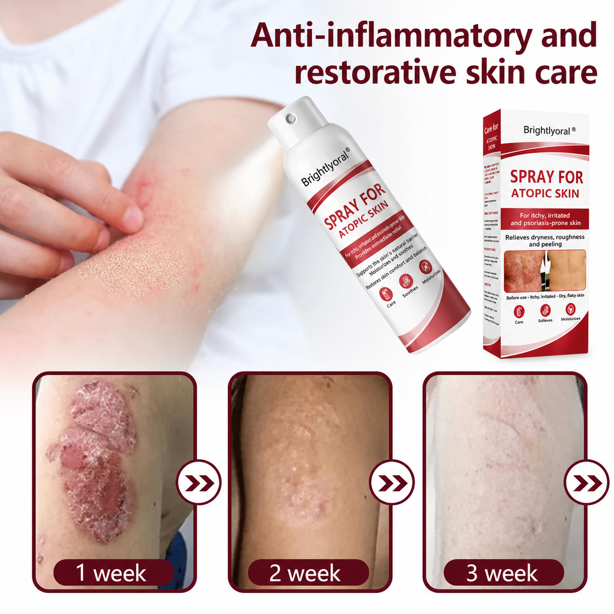 🔴Brightlyoral® Beef Tallow Spray for itchy—flaking skin associated with psoriasis🐓