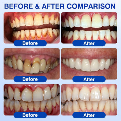 👨‍⚕️🦷🛡️BBOJI®GumRevive Periodontal Repair Gel