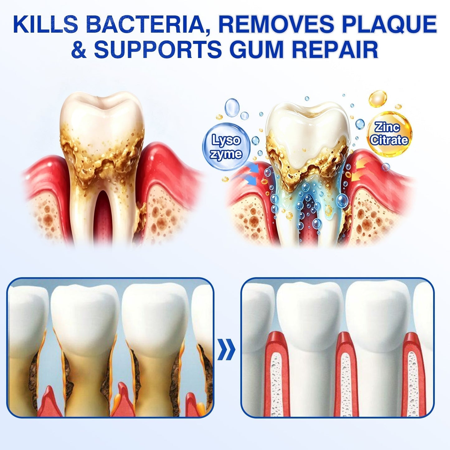 👨‍⚕️🦷🛡️BBOJI®GumRevive Periodontal Repair Gel