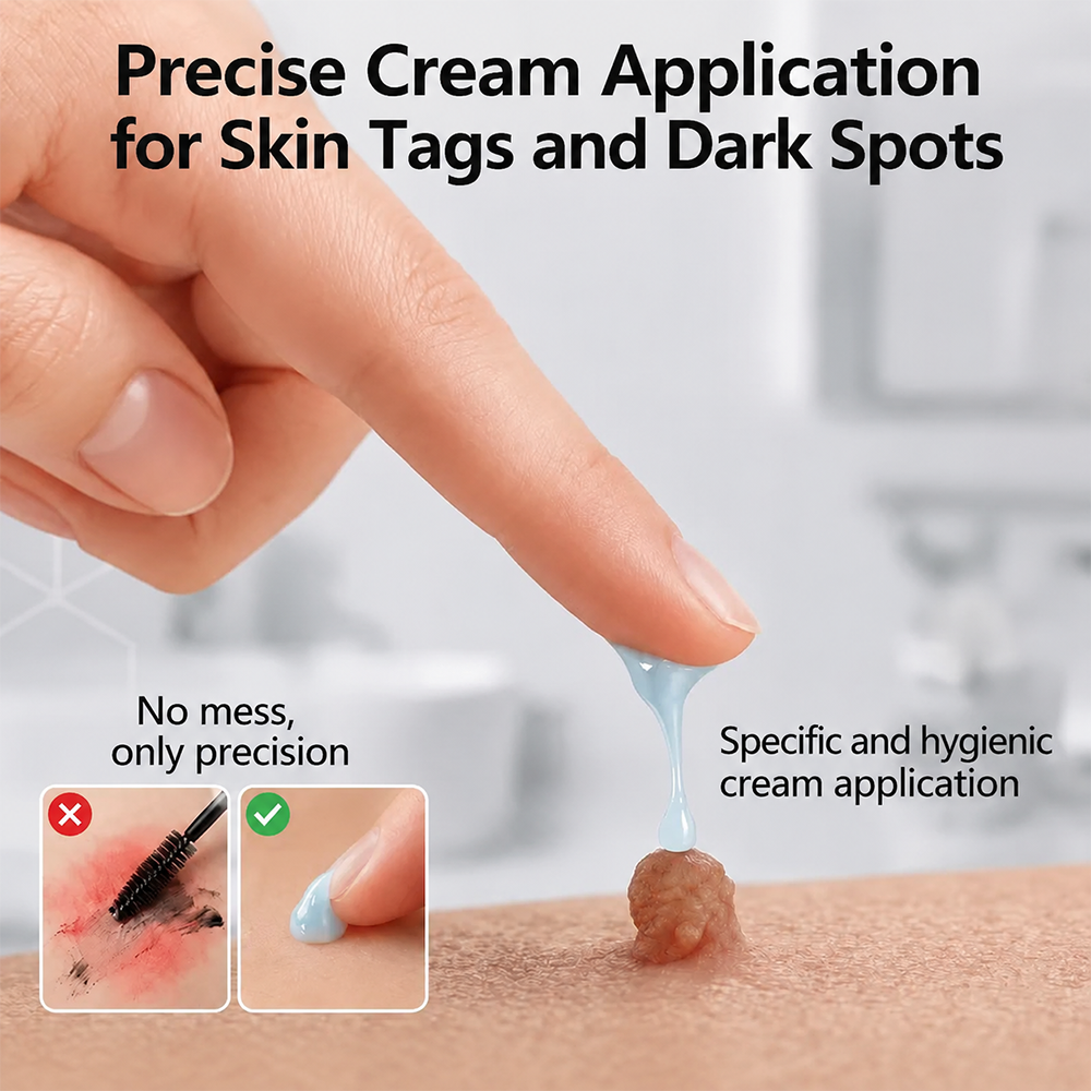 TERVENCE® 🧑‍⚕️ 7-Day Cream for Skin Growths & Pigmentation Spots (painless formula – scar-free)🌿2️⃣