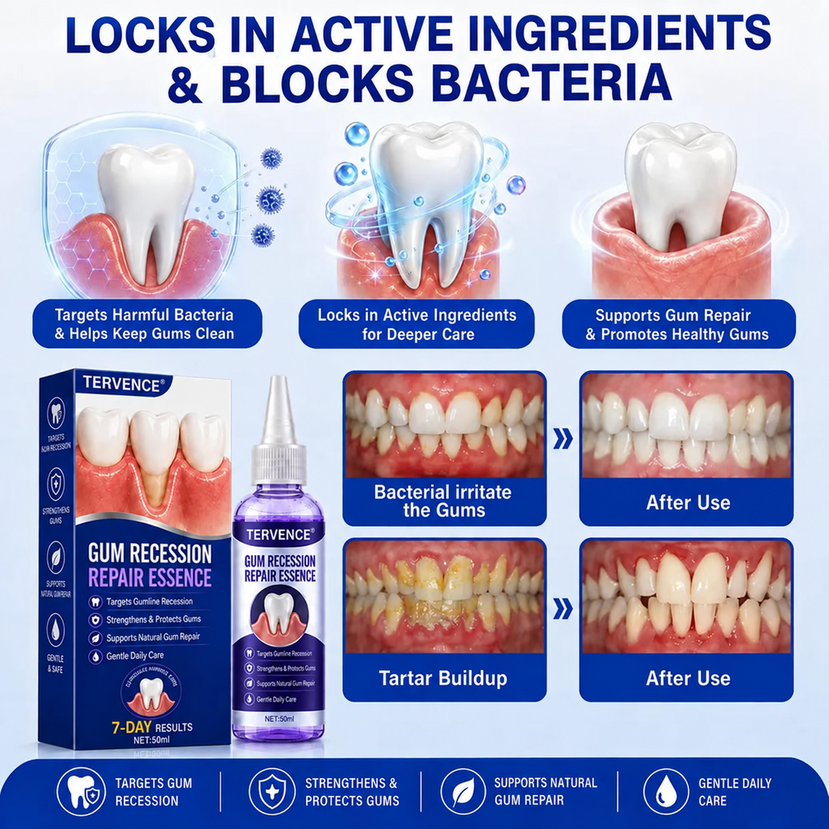 TERVENCE® 🏆GumRevive Periodontal Care Gel