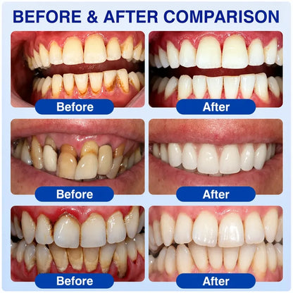 TERVENCE® 🏆GumRevive Periodontal Care Gel