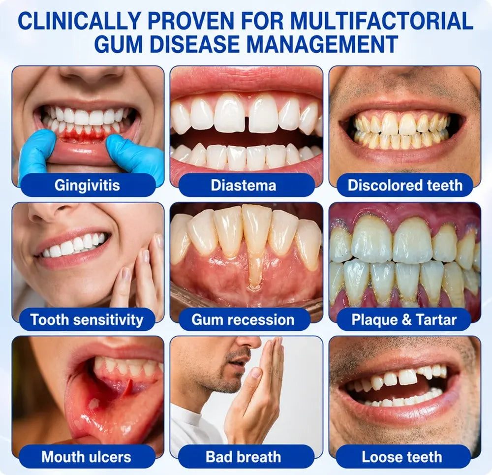 TERVENCE® 🏆GumRevive Periodontal Care Gel