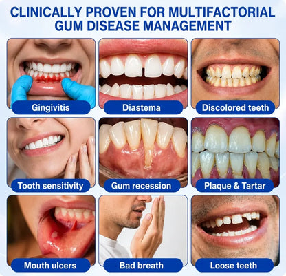 TERVENCE® 🏆GumRevive Periodontal Care Gel