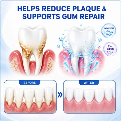 TERVENCE® 🏆GumRevive Periodontal Care Gel