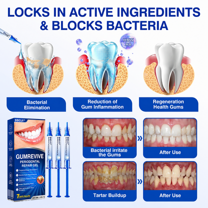 👨‍⚕️🦷🛡️BBOJI®GumRevive Periodontal Repair Gel