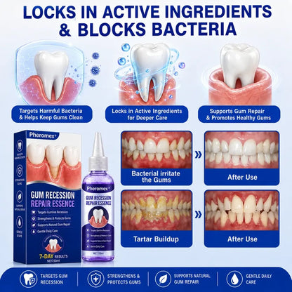 TERVENCE® 🏆GumRevive Periodontal Care Gel
