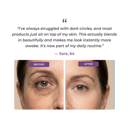 EyeCorrect+ Undereye Brightener（+ FREE Undereye Precision Brush）
