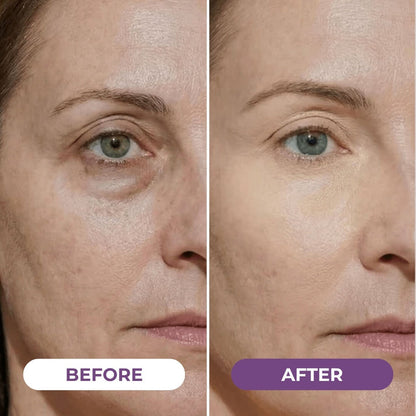 EyeCorrect+ Undereye Brightener（+ FREE Undereye Precision Brush）