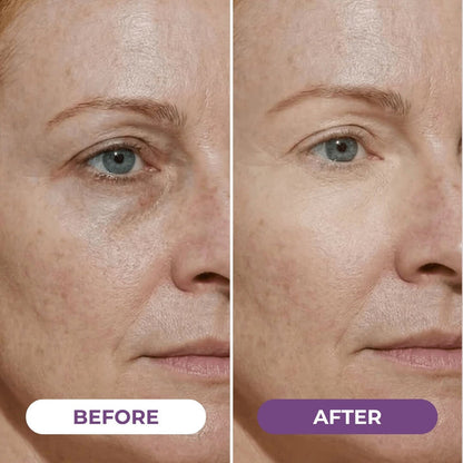 EyeCorrect+ Undereye Brightener（+ FREE Undereye Precision Brush）
