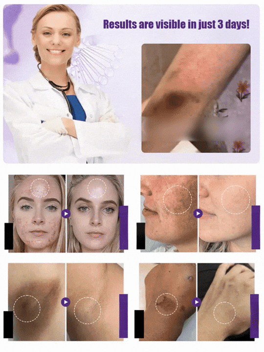 💜Highly effective whitening and spot-lightening cream